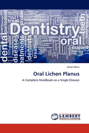 Oral Lichen Planus: A Complete Handbook on a Single Disease,Used
