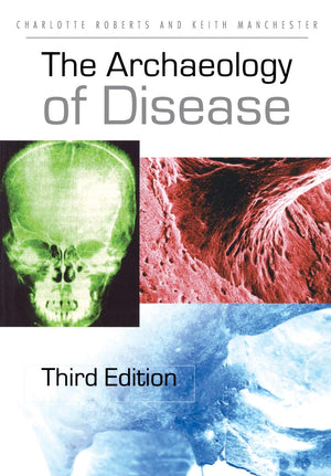 The Archaeology Of Disease,Used