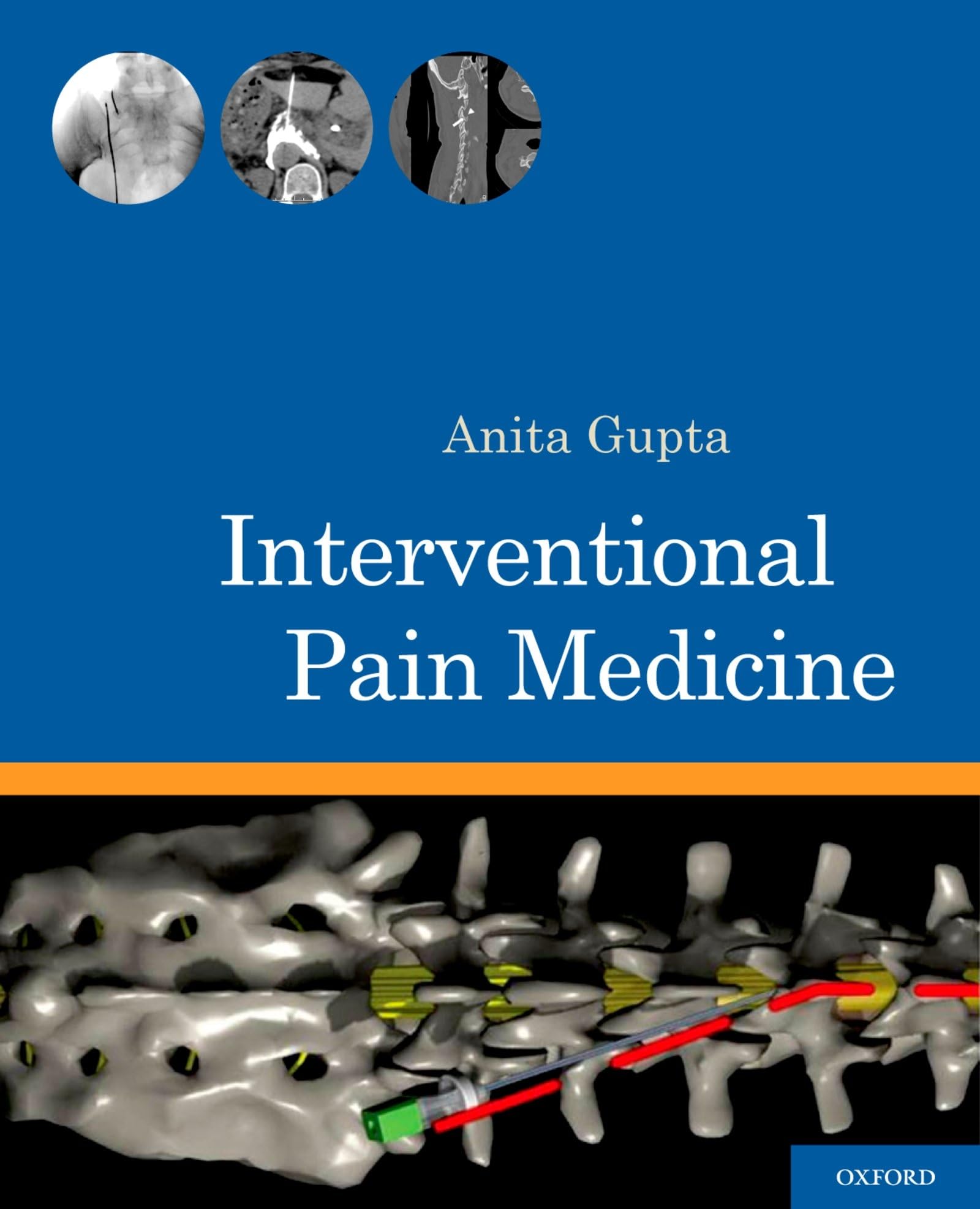 Interventional Pain Medicine,Used