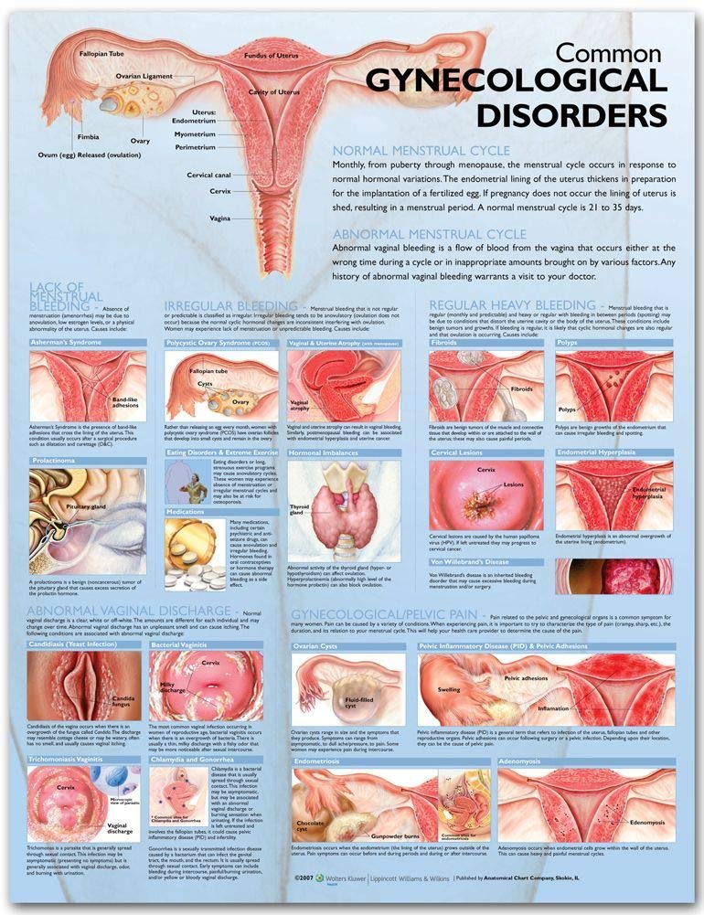 Common Gynecological Disorders Anatomical Chart,Used