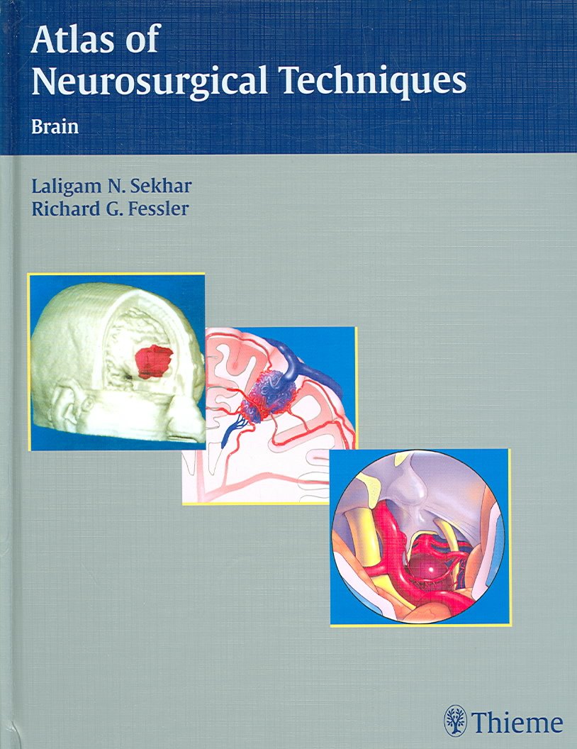 Atlas of Neurosurgical Techniques: Brain