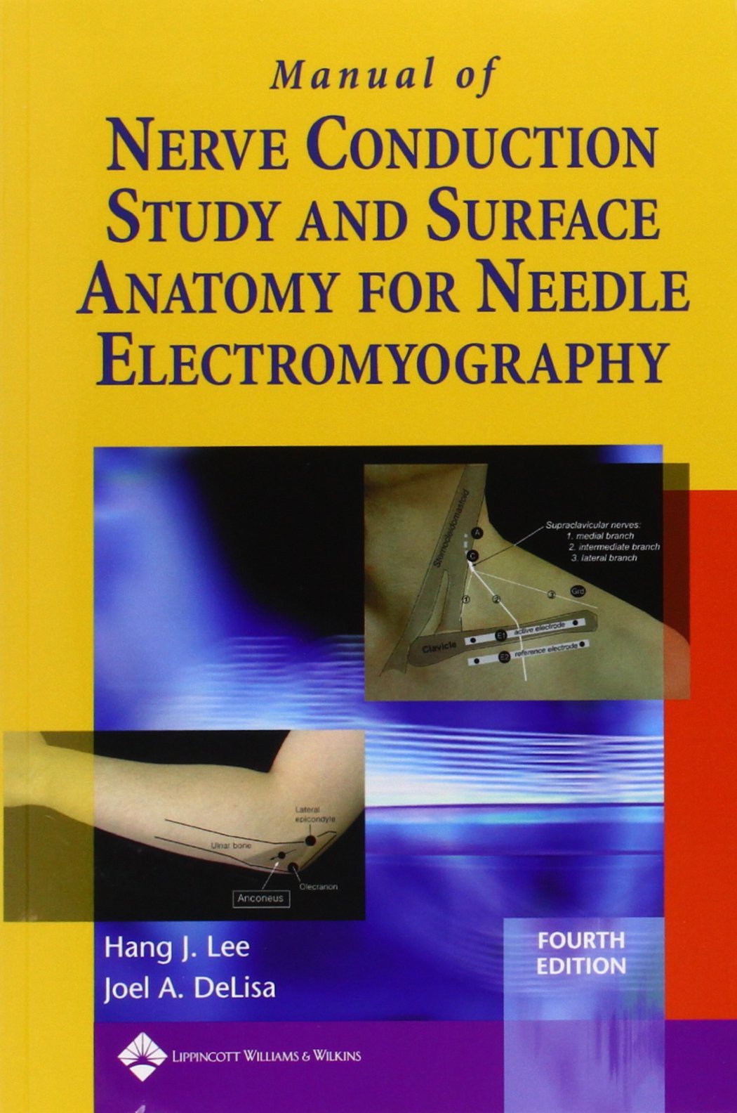 Manual of Nerve Conduction Study and Surface Anatomy for Needle Electromyography,New