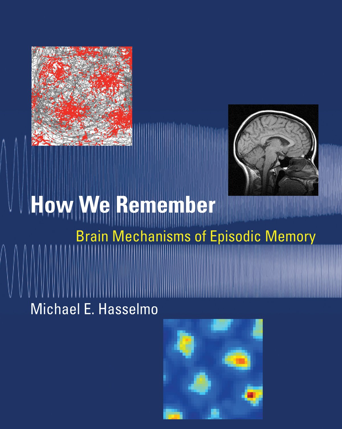 How We Remember: Brain Mechanisms of Episodic Memory,Used