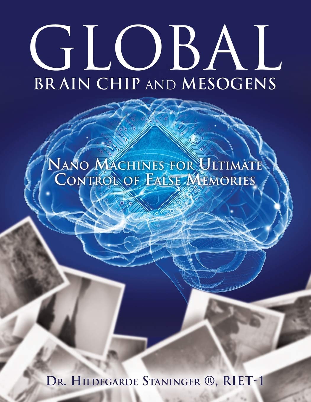 Global Brain Chip and Mesogens,Used
