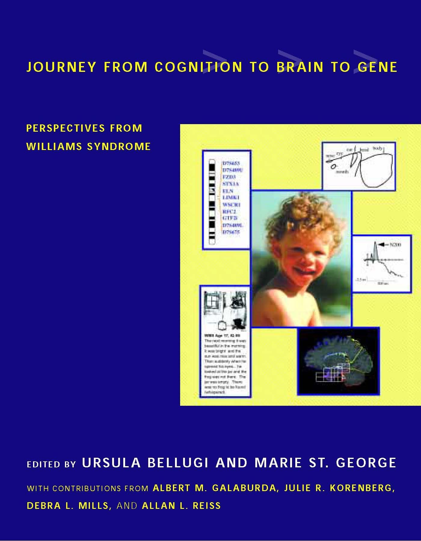 Journey from Cognition to Brain to Gene: Perspectives from Williams Syndrome,Used