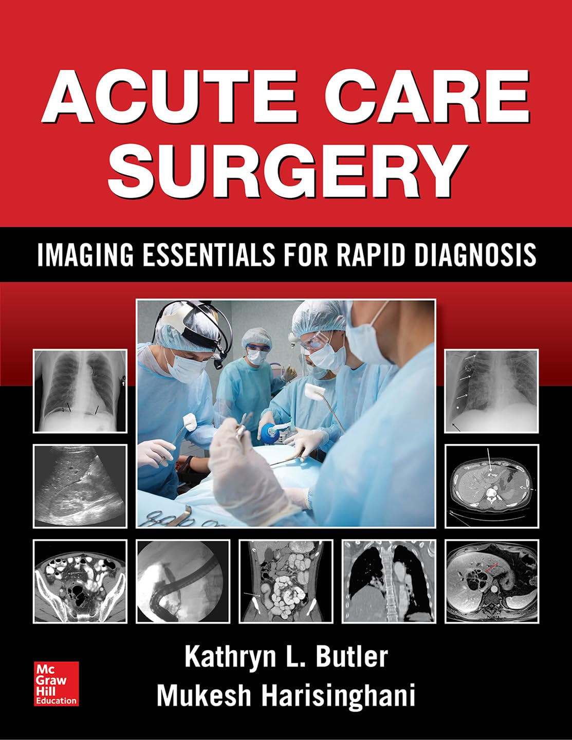 Acute Care Surgery: Imaging Essentials for Rapid Diagnosis,Used