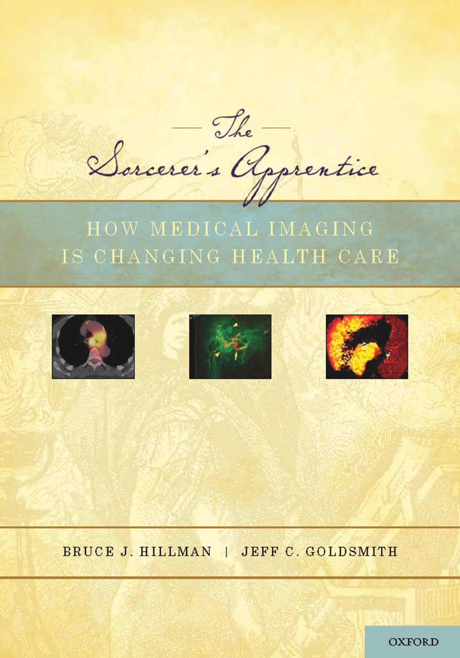 The Sorcerer's Apprentice: How Medical Imaging Is Changing Health Care,Used