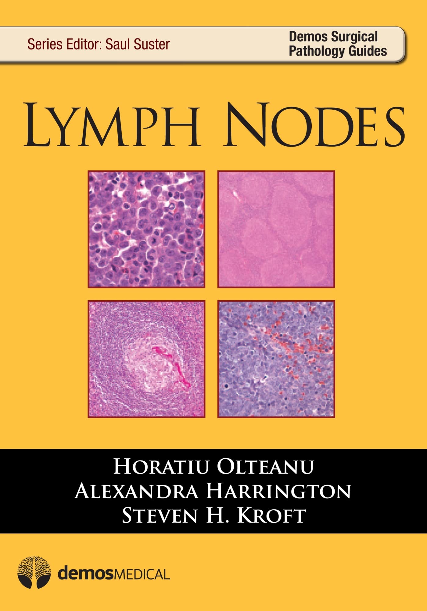 Lymph Nodes (Demos Surgical Pathology Guides),Used