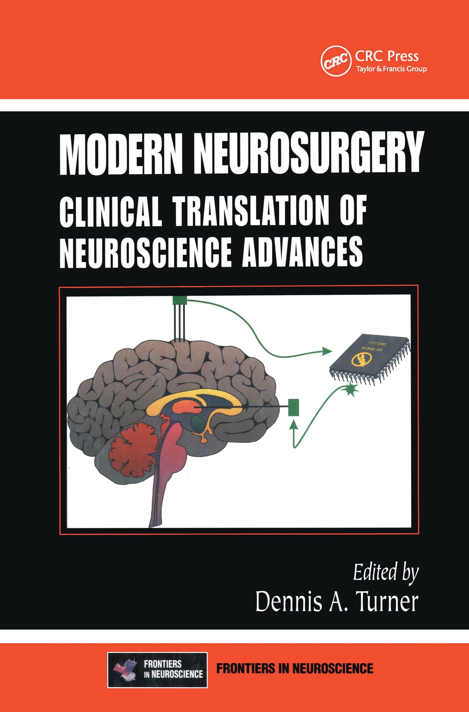 Modern Neurosurgery: Clinical Translation of Neuroscience Advances,Used