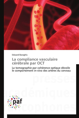 La compliance vasculaire crbrale par OCT: La tomographie par cohrence optique dvoile le comportement invivo des artres ,Used