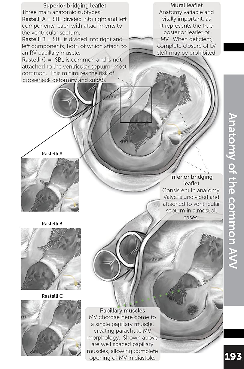 Boston Children's Hospital Cardiac ICU Manual For Bedside Providers  an illustrated handbook of congenital heart disease,New