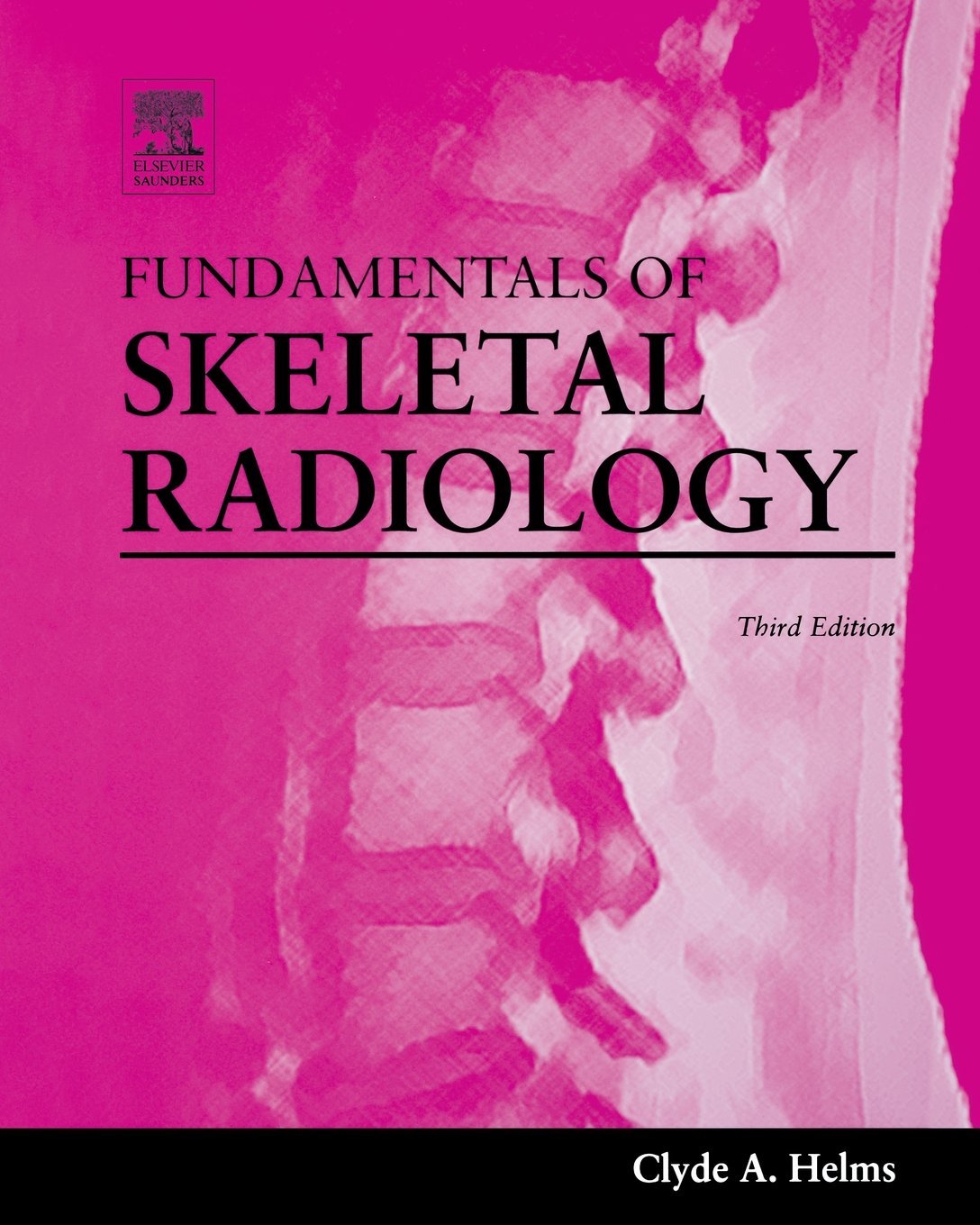 Fundamentals Of Skeletal Radiology,New