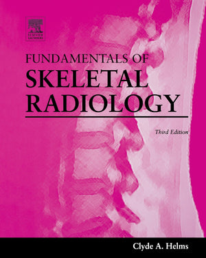 Fundamentals Of Skeletal Radiology,New