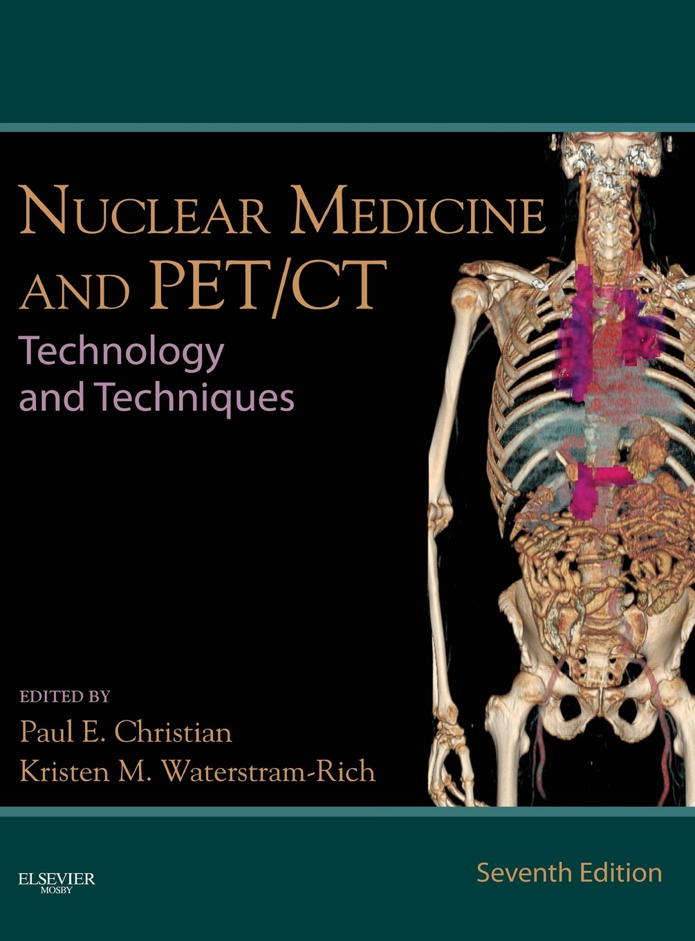 Nuclear Medicine and PET/CT: Technology and Techniques,Used
