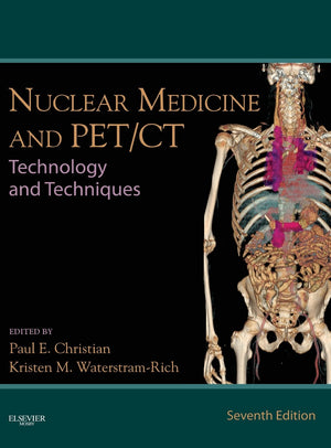 Nuclear Medicine and PET/CT: Technology and Techniques,Used