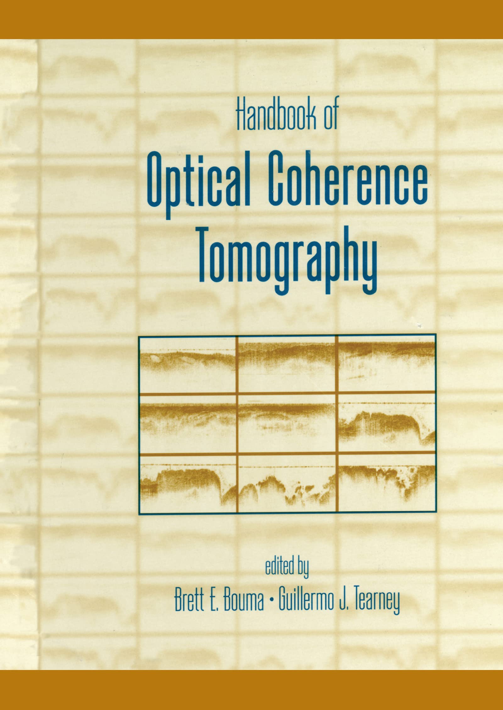 Handbook of Optical Coherence Tomography,Used