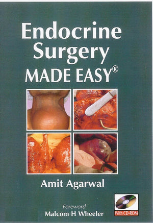 Endocrine Surgery Made Easy,Used