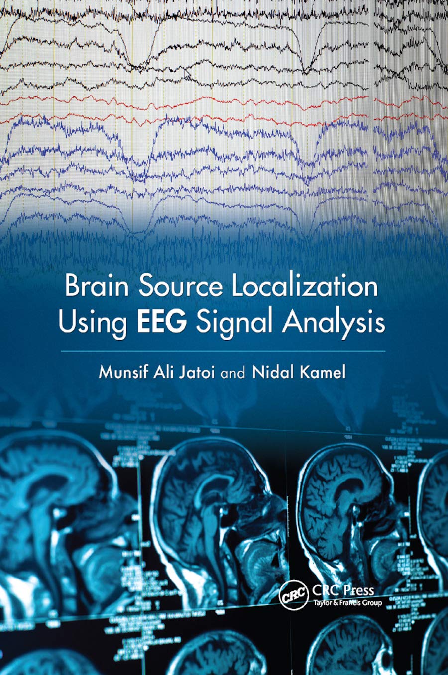 Brain Source Localization Using EEG Signal Analysis,New