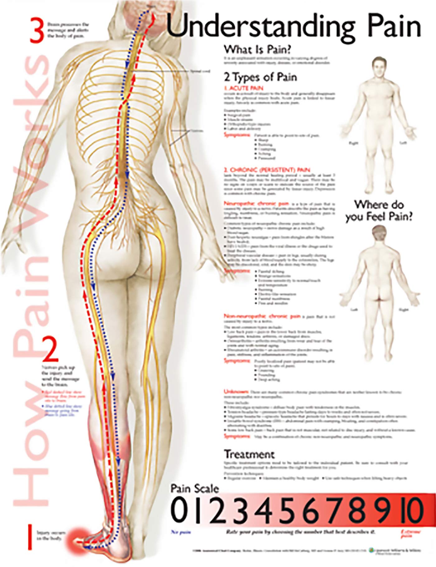 Understanding Pain Anatomical Chart,Used
