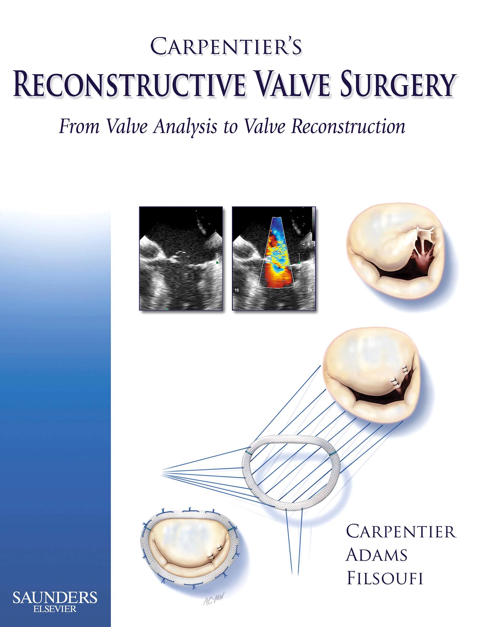 Carpentier's Reconstructive Valve Surgery,Used