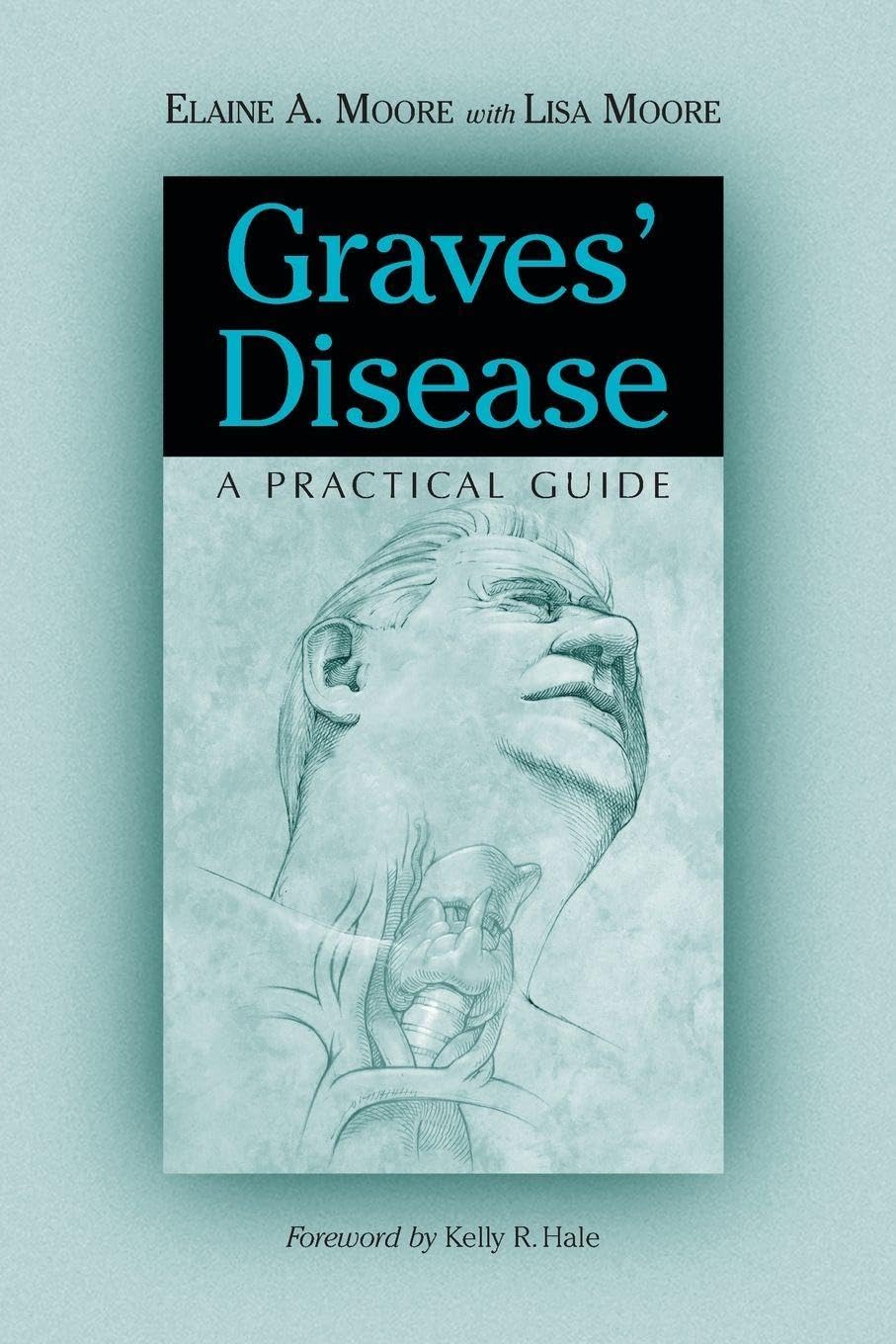 Graves Disease: A Practical Guide (McFarland Health Topics)