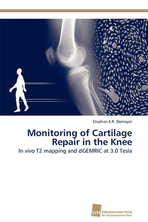 Monitoring of Cartilage Repair in the Knee: In vivo T2 mapping and dGEMRIC at 3.0 Tesla,Used