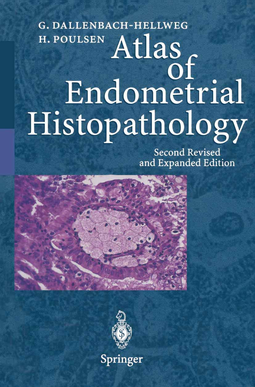 Atlas of Endometrial Histopathology,Used