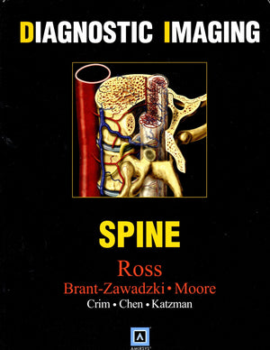 Diagnostic Imaging: Spine,Used