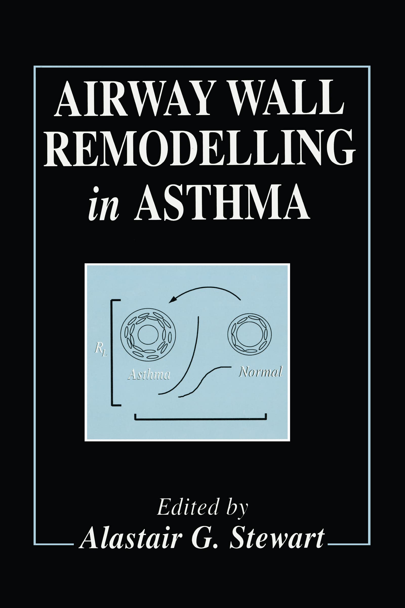 Airway Wall Remodelling in Asthma (Handbooks in Pharmacology and Toxicology),Used