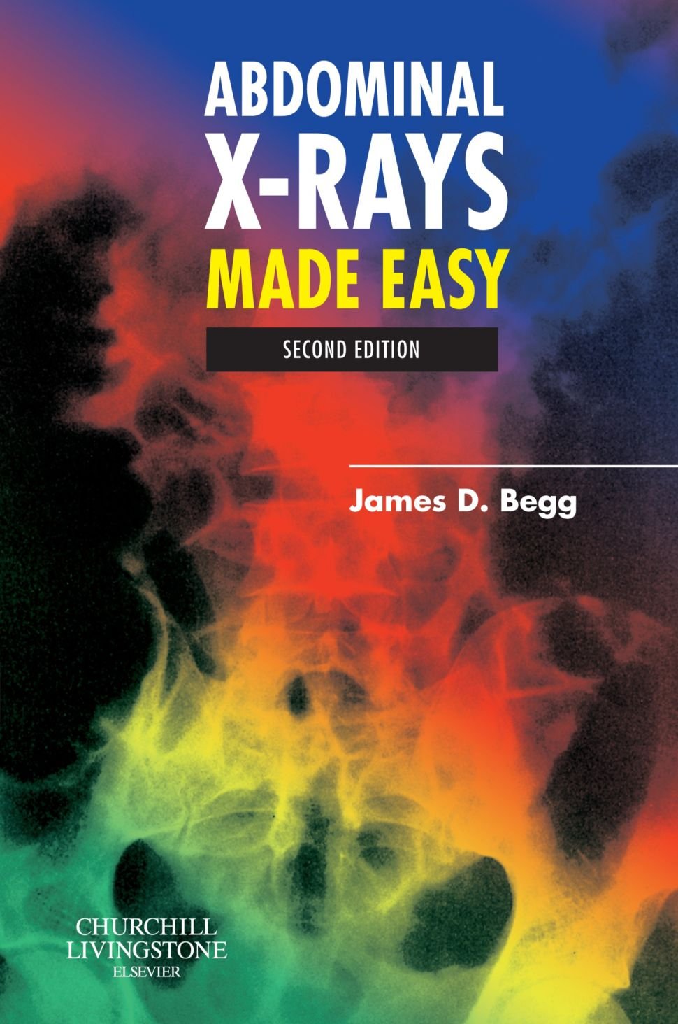 Abdominal Xrays Made Easy,New