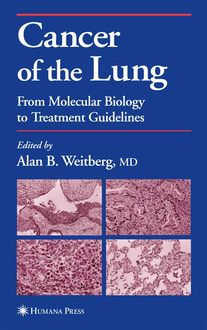 Cancer of the Lung: From Molecular Biology to Treatment Guidelines (Current Clinical Oncology),Used