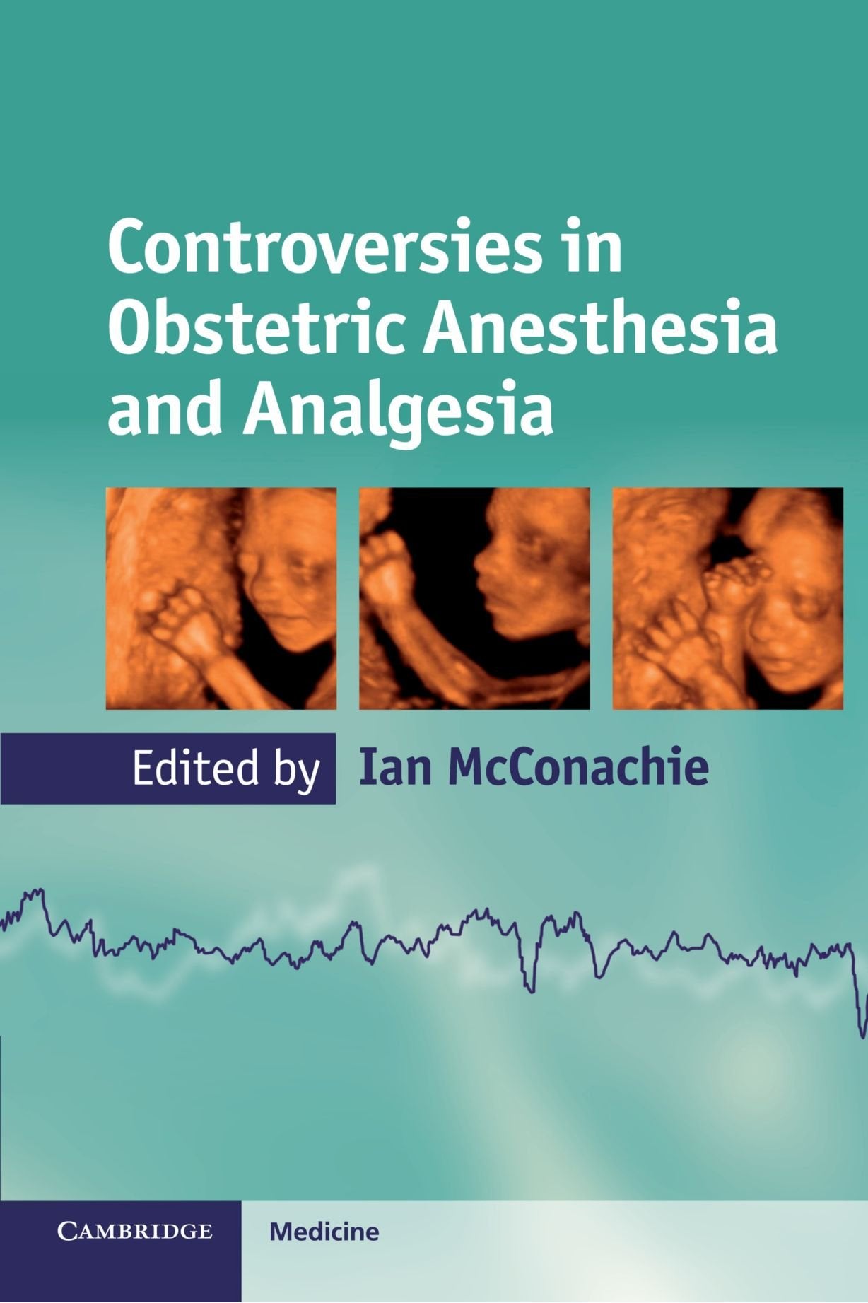 Controversies in Obstetric Anesthesia and Analgesia (Cambridge Medicine (Paperback)),Used