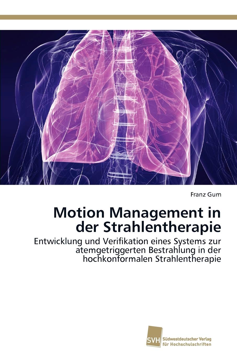 Motion Management in der Strahlentherapie: Entwicklung und Verifikation eines Systems zur atemgetriggerten Bestrahlung in der ho,Used