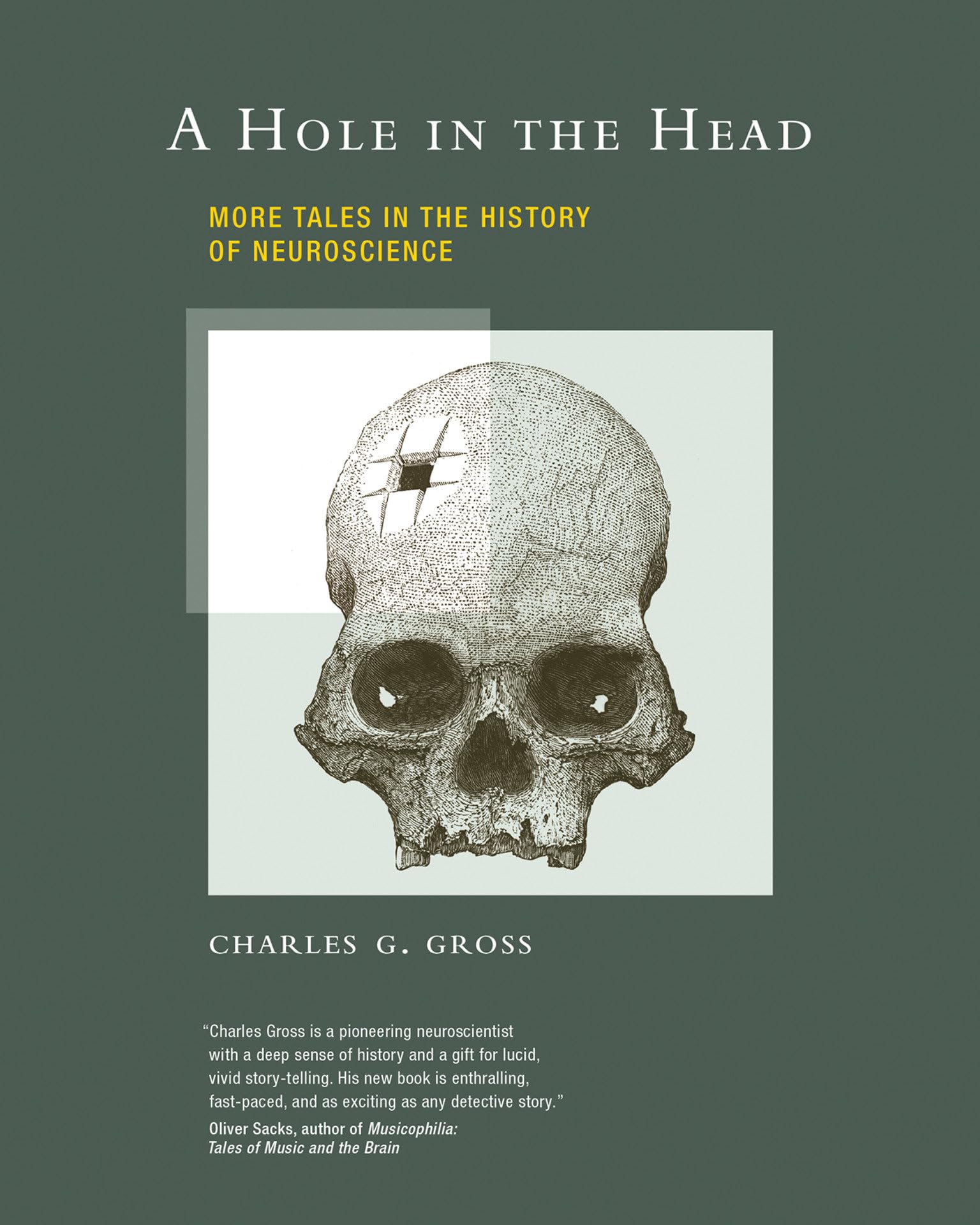 A Hole In The Head: More Tales In The History Of Neuroscience (Mit Press)