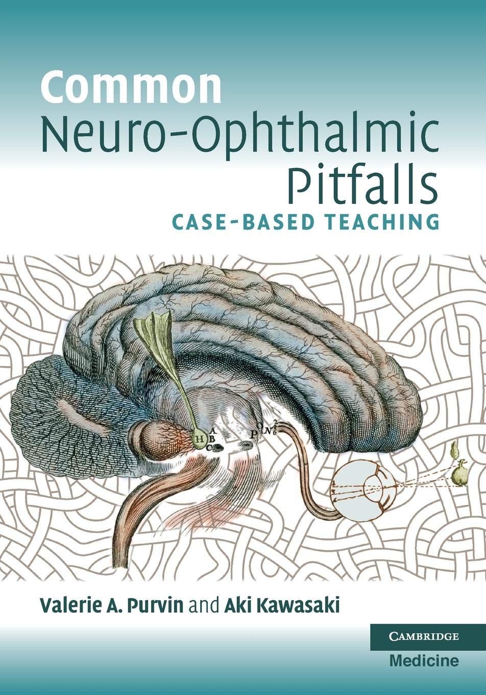 Common NeuroOphthalmic Pitfalls: CaseBased Teaching (Cambridge Medicine (Paperback))