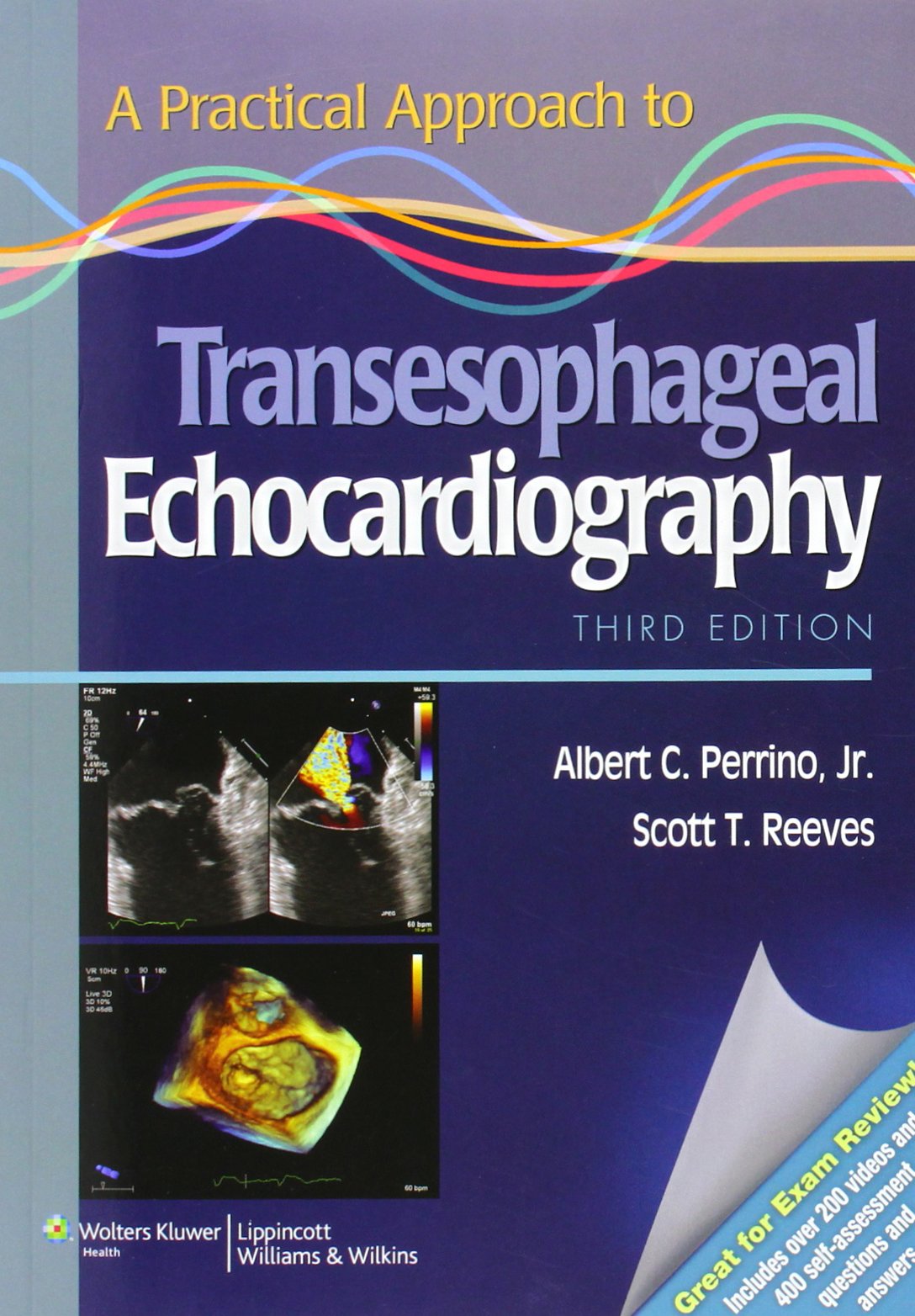 A Practical Approach To Transesophageal Echocardiography