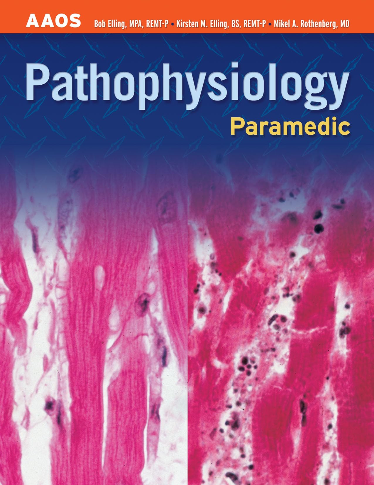 Paramedic: Pathophysiology: Pathophysiology (Aaos Paramedic),Used