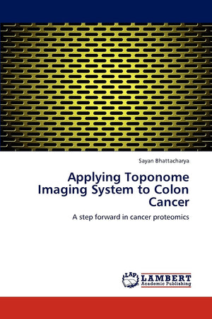 Applying Toponome Imaging System to Colon Cancer: A step forward in cancer proteomics,Used