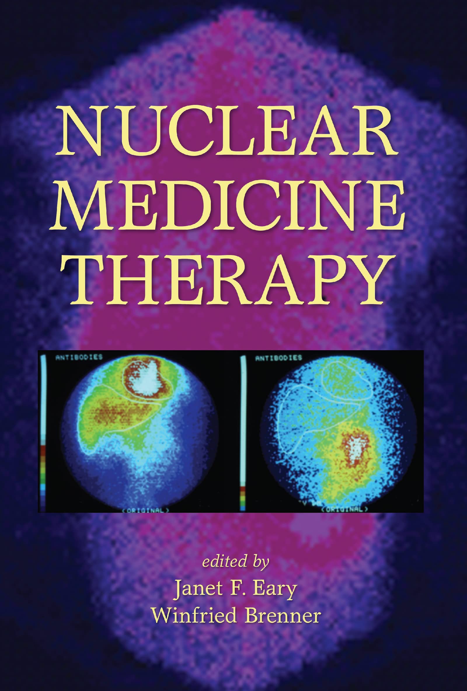 Nuclear Medicine Therapy,Used