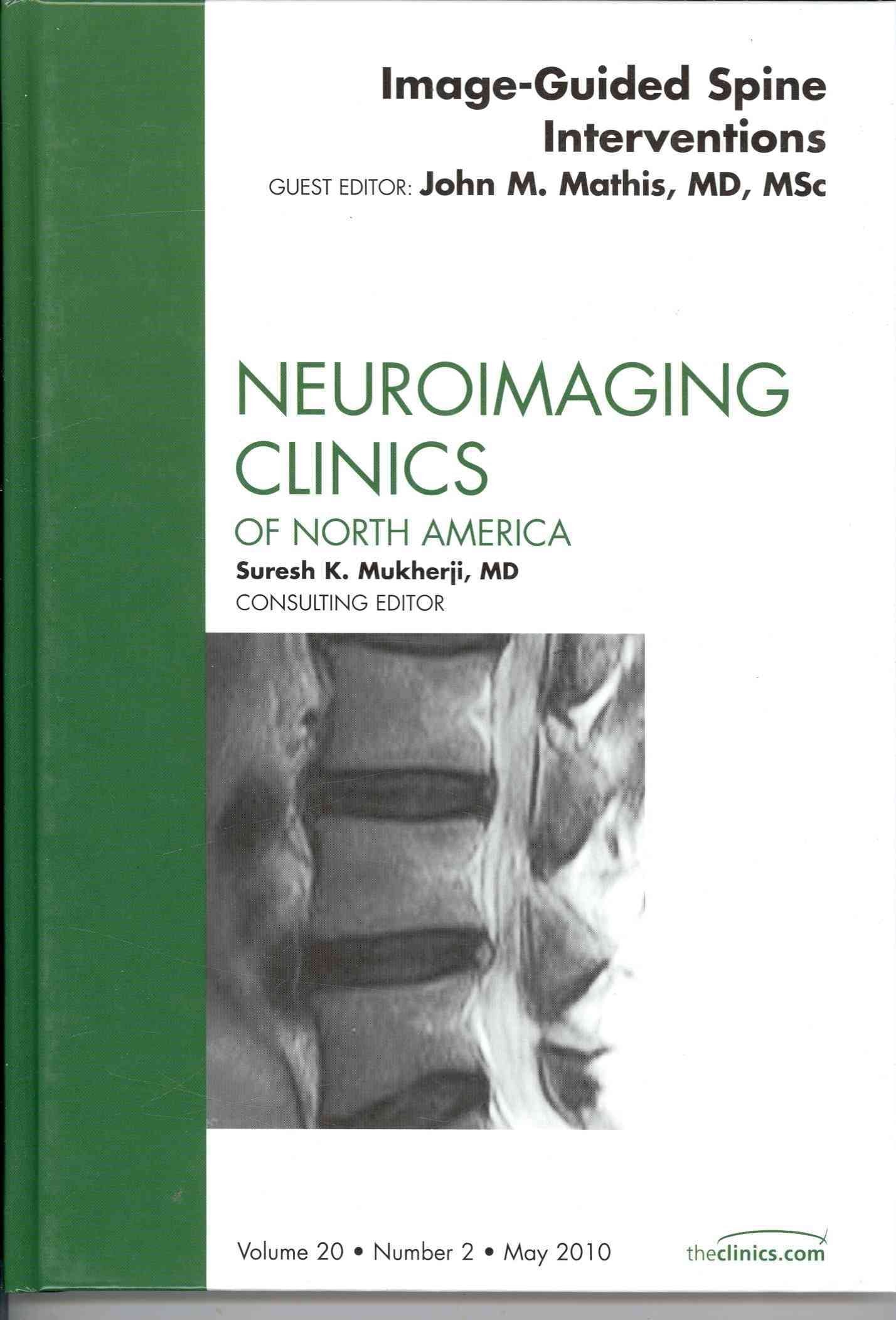 ImageGuided Spine Interventions, An Issue of Neuroimaging Clinics (Volume 202) (The Clinics: Radiology, Volume 202),Used