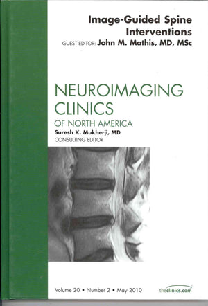 ImageGuided Spine Interventions, An Issue of Neuroimaging Clinics (Volume 202) (The Clinics: Radiology, Volume 202),Used