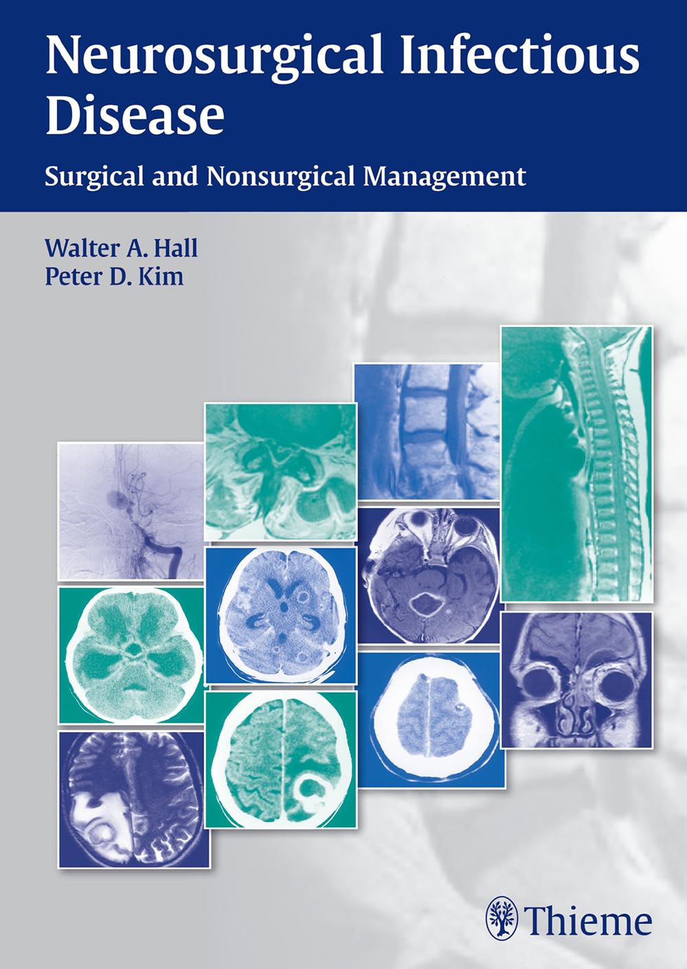 Neurosurgical Infectious Disease: Surgical And Nonsurgical Management,Used