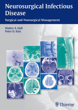 Neurosurgical Infectious Disease: Surgical And Nonsurgical Management,Used