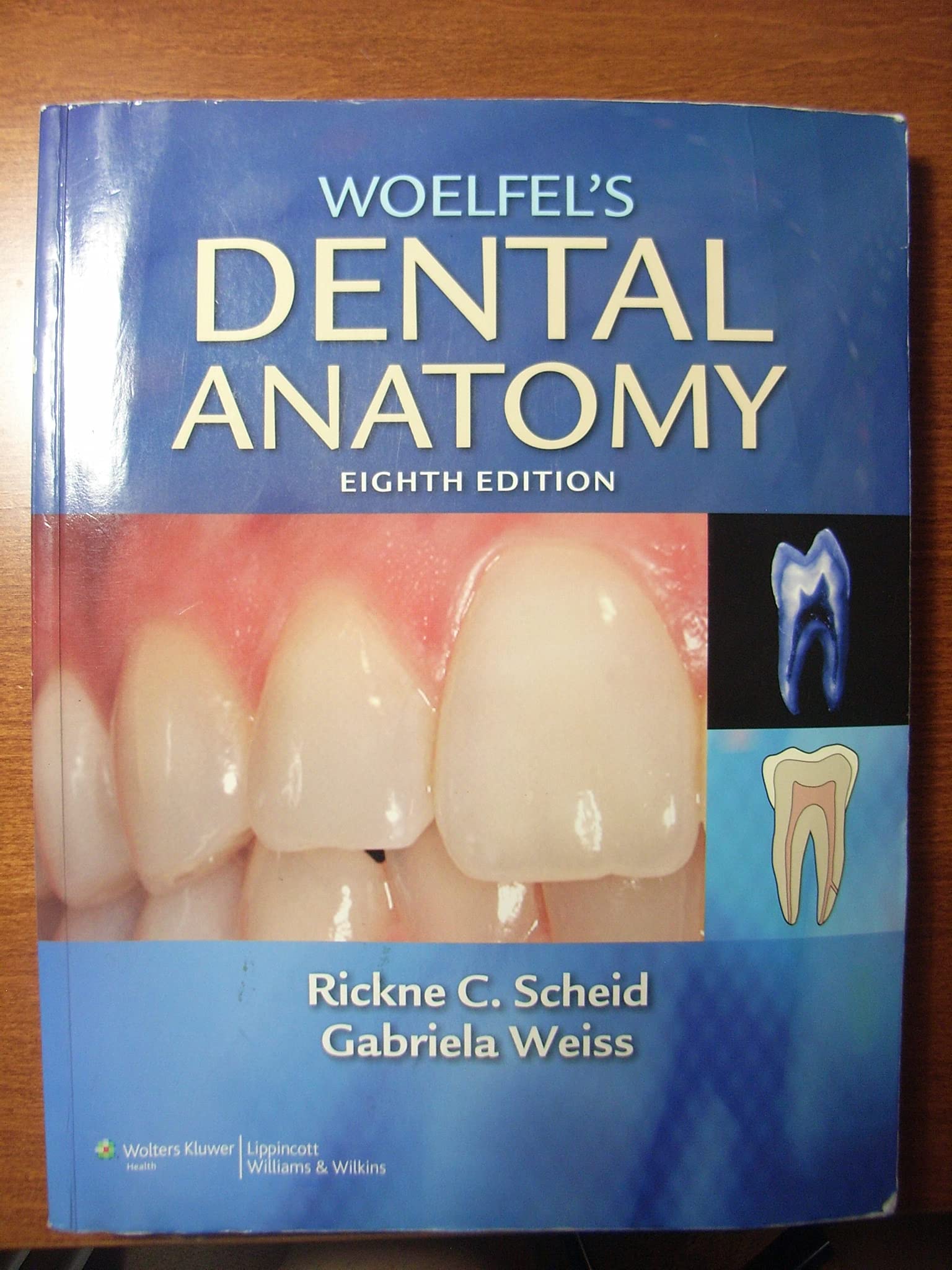 Woelfel's Dental Anatomy,Used