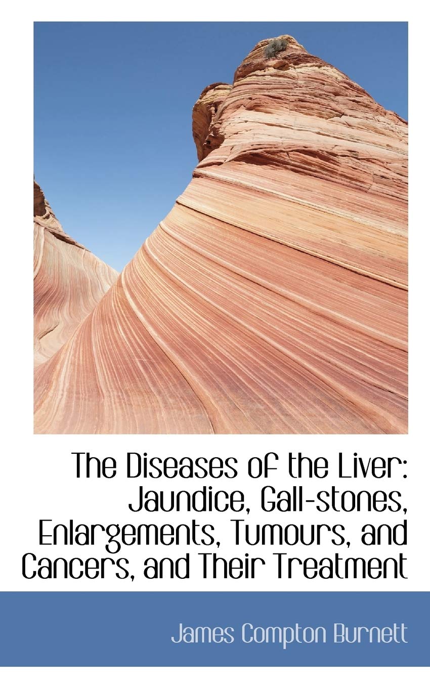 The Diseases of the Liver: Jaundice, Gallstones, Enlargements, Tumours, and Cancers, and Their Treatment,New