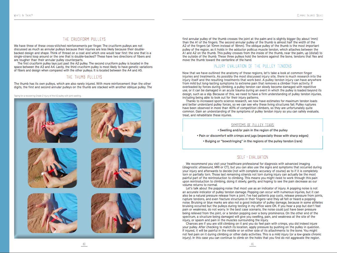 Climbing Injuries Solved,Used