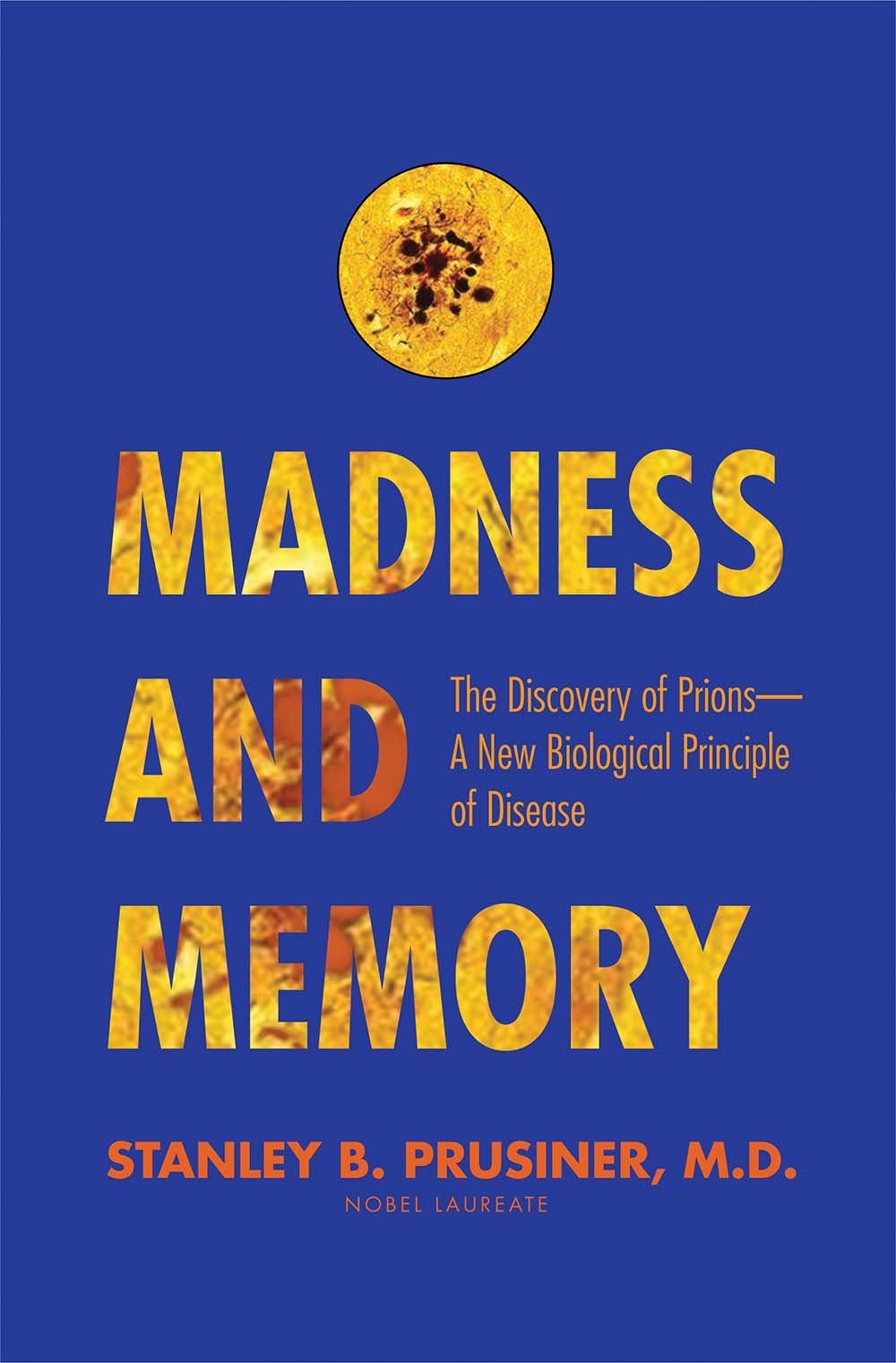 Madness And Memory: The Discovery Of Prionsa New Biological Principle Of Disease