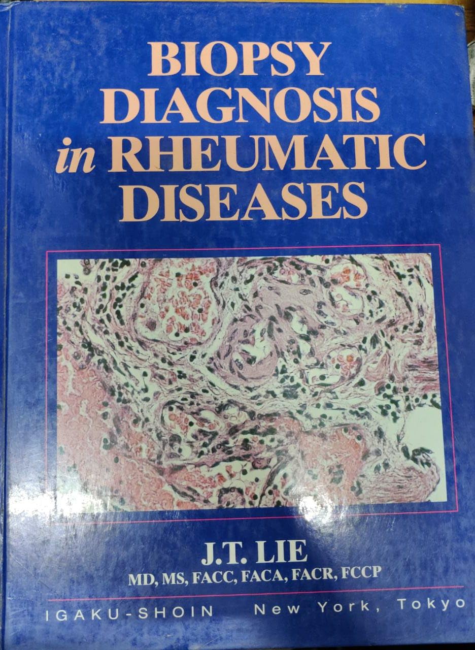Biopsy Diagnosis in Rheumatic Diseases,Used