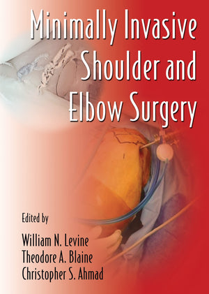 Minimally Invasive Shoulder and Elbow Surgery (Minimally Invasive Procedures in Orthopaedic Surgery, 1),Used