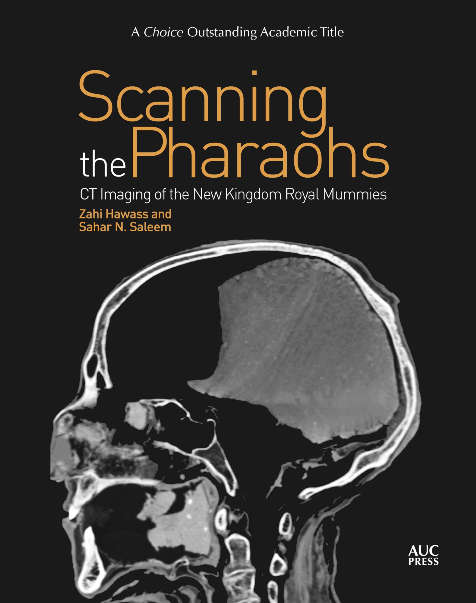 Scanning The Pharaohs: Ct Imaging Of The New Kingdom Royal Mummies